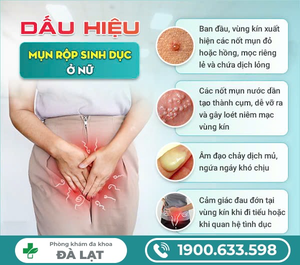 Hình ảnh minh họa